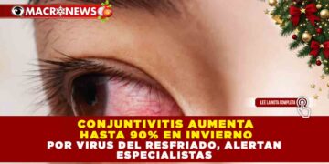 CONJUNTIVITIS AUMENTA HASTA 90% EN INVIERNO POR VIRUS DEL RESFRIADO, ALERTAN ESPECIALISTAS