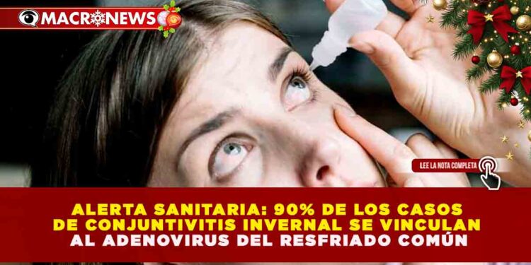 ALERTA SANITARIA: 90% DE LOS CASOS DE CONJUNTIVITIS INVERNAL SE VINCULAN AL ADENOVIRUS DEL RESFRIADO COMÚN