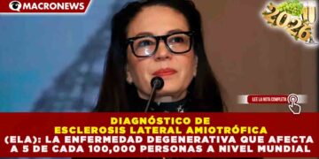 DIAGNÓSTICO DE ELA: LA ENFERMEDAD DEGENERATIVA QUE AFECTA A 5 DE CADA 100,000 PERSONAS A NIVEL MUNDIAL