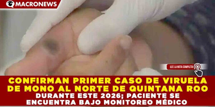 CONFIRMAN PRIMER CASO DE VIRUELA DE MONO AL NORTE DE QUINTANA ROO DURANTE ESTE 2026; PACIENTE SE ENCUENTRA BAJO MONITOREO MÉDICO