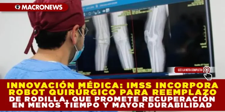 INNOVACIÓN MÉDICA: IMSS INCORPORA ROBOT QUIRÚRGICO PARA REEMPLAZO DE RODILLA QUE PROMETE RECUPERACIÓN EN MENOS TIEMPO Y MAYOR DURABILIDAD