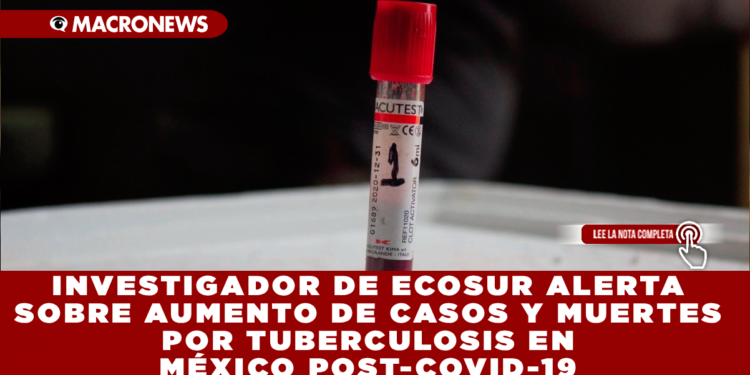 INVESTIGADOR DE ECOSUR ALERTA SOBRE AUMENTO DE CASOS Y MUERTES POR TUBERCULOSIS EN MÉXICO POST-COVID-19
