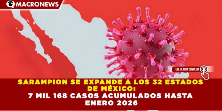 SARAMPION SE EXPANDE A LOS 32 ESTADOS DE MÉXICO: 7 MIL 168 CASOS ACUMULADOS HASTA ENERO 2026