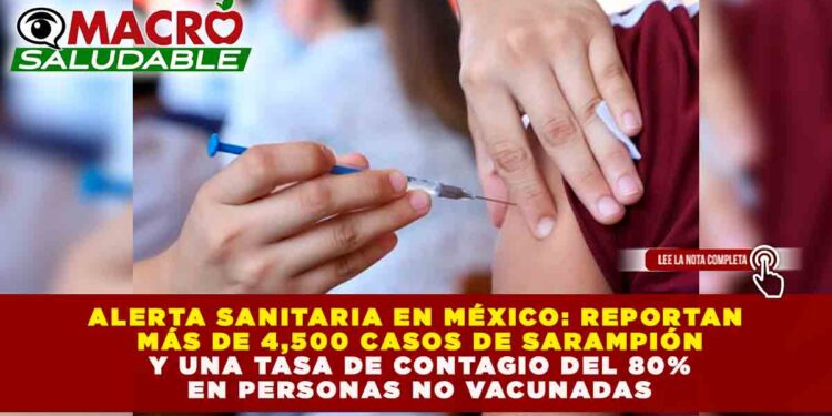 ALERTA SANITARIA EN MÉXICO: REPORTAN MÁS DE 4,500 CASOS DE SARAMPIÓN Y UNA TASA DE CONTAGIO DEL 80% EN PERSONAS NO VACUNADAS