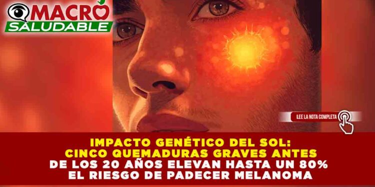 IMPACTO GENÉTICO DEL SOL: CINCO QUEMADURAS GRAVES ANTES DE LOS 20 AÑOS ELEVAN HASTA UN 80% EL RIESGO DE PADECER MELANOMA
