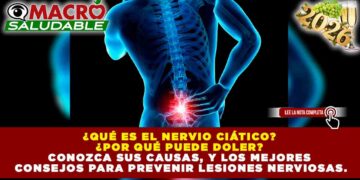 EL 80% DE LA POBLACIÓN MUNDIAL PADECERÁ AFECCIONES LUMBARES: EL IMPACTO DE LA CIÁTICA EN LA SALUD PÚBLICA