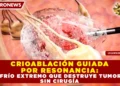 CRIOABLACIÓN GUIADA POR RESONANCIA: EL FRÍO EXTREMO QUE DESTRUYE TUMORES SIN CIRUGÍA