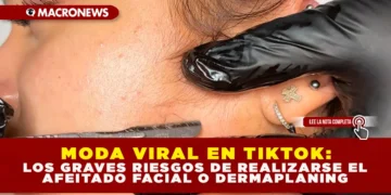 MODA VIRAL EN TIKTOK: LOS GRAVES RIESGOS DE REALIZARSE EL AFEITADO FACIAL O DERMAPLANING
