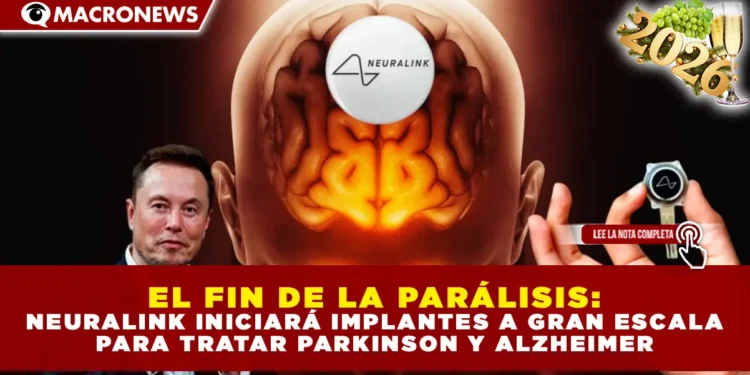 EL FIN DE LA PARÁLISIS: NEURALINK INICIARÁ IMPLANTES A GRAN ESCALA PARA TRATAR PARKINSON Y ALZHEIMER