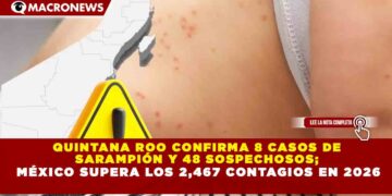 QUINTANA ROO CONFIRMA 8 CASOS DE  SARAMPIÓN Y 48 SOSPECHOSOS;  MÉXICO SUPERA LOS 2,467 CONTAGIOS EN 2026
