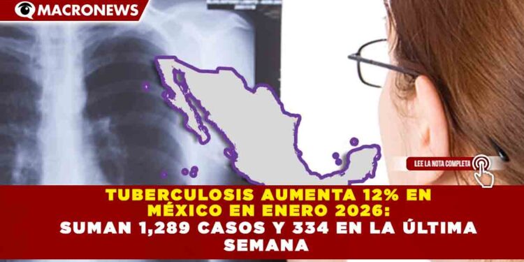 TUBERCULOSIS AUMENTA 12% EN MÉXICO EN ENERO 2026: SUMAN 1,289 CASOS Y 334 EN LA ÚLTIMA SEMANA
