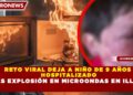 RETO VIRAL DEJA A NIÑO DE 9 AÑOS HOSPITALIZADO TRAS EXPLOSIÓN EN MICROONDAS EN ILLINOIS