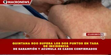 QUINTANA ROO SUPERA LOS 2 PUNTOS EN TASA DE INCIDENCIA DE SARAMPIÓN Y ACUMULA 46 CASOS CONFIRMADOS