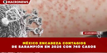 MÉXICO ENCABEZA CONTAGIOS DE SARAMPIÓN EN 2026 CON 740 CASOS