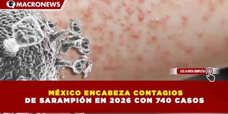 MÉXICO ENCABEZA CONTAGIOS DE SARAMPIÓN EN 2026 CON 740 CASOS