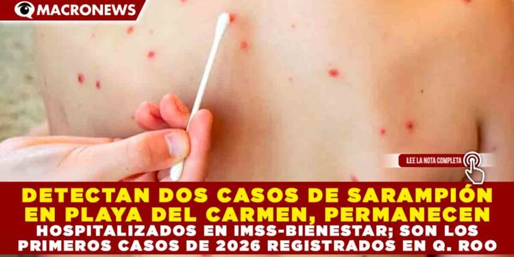DETECTAN DOS CASOS DE SARAMPIÓN EN PLAYA DEL CARMEN, LOS ATIENDEN EN IMSS-BIENESTAR; PRIMEROS CASOS DE 2026 REGISTRADOS EN Q. ROO
