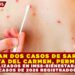 DETECTAN DOS CASOS DE SARAMPIÓN EN PLAYA DEL CARMEN, LOS ATIENDEN EN IMSS-BIENESTAR; PRIMEROS CASOS DE 2026 REGISTRADOS EN Q. ROO