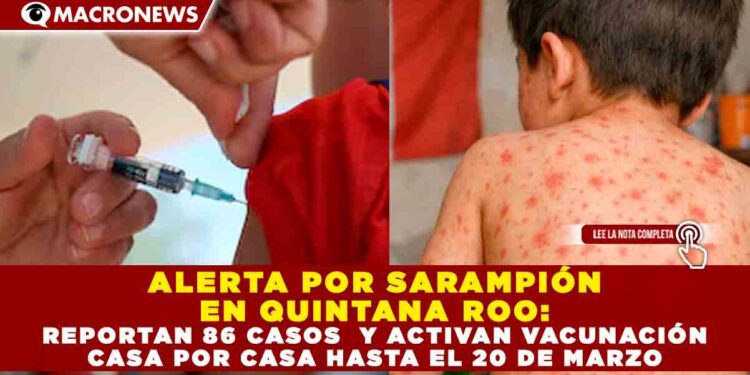 ALERTA POR SARAMPIÓN EN QUINTANA ROO: REPORTAN 86 CASOS Y ACTIVAN VACUNACIÓN CASA POR CASA HASTA EL 20 DE MARZO
