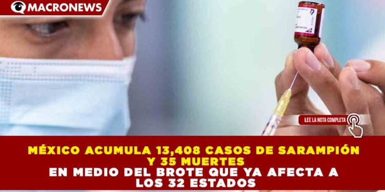 MÉXICO ACUMULA 13,408 CASOS DE SARAMPIÓN Y 35 MUERTES EN MEDIO DEL BROTE QUE YA AFECTA A LOS 32 ESTADOS
