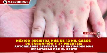 MÉXICO REGISTRA MÁS DE 12 MIL CASOS  DE SARAMPIÓN Y 34 MUERTES; AUTORIDADES REPORTAN LAS ENTIDADES MÁS  IMPACTADAS POR EL BROTE
