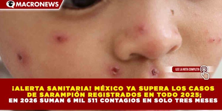 ¡ALERTA SANITARIA! MÉXICO YA SUPERA LOS CASOS DE SARAMPIÓN REGISTRADOS EN TODO 2025; EN 2026 SUMAN 6 MIL 511 CONTAGIOS EN SOLO TRES MESES