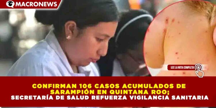 CONFIRMAN 106 CASOS ACUMULADOS DE SARAMPIÓN EN QUINTANA ROO; SECRETARÍA DE SALUD REFUERZA VIGILANCIA SANITARIA