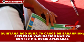 QUINTANA ROO SUMA 70 CASOS DE SARAMPIÓN; ACELERAN VACUNACIÓN MASIVA CON 150 MIL DOSIS APLICADAS