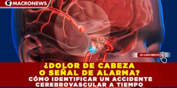 ¿DOLOR DE CABEZA O SEÑAL DE ALARMA? CÓMO IDENTIFICAR UN ACCIDENTE CEREBROVASCULAR A TIEMPO