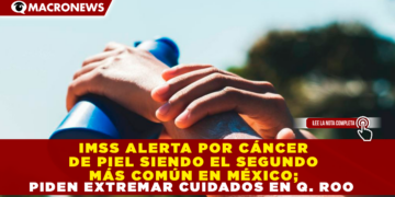IMSS ALERTA: CÁNCER DE PIEL ES EL SEGUNDO MÁS COMÚN EN MÉXICO; PIDEN EXTREMAR CUIDADOS EN Q. ROO