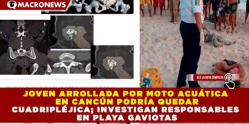 JOVEN ARROLLADA POR MOTO ACUÁTICA EN CANCÚN PODRÍA QUEDAR CUADRIPLÉJICA; INVESTIGAN RESPONSABLES EN PLAYA GAVIOTAS