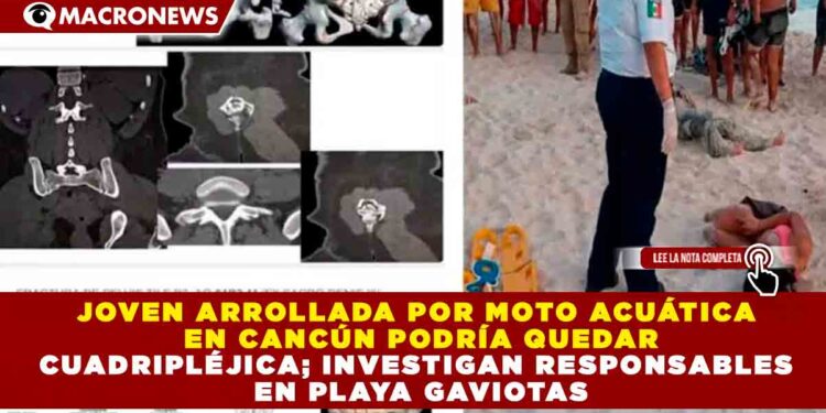 JOVEN ARROLLADA POR MOTO ACUÁTICA EN CANCÚN PODRÍA QUEDAR CUADRIPLÉJICA; INVESTIGAN RESPONSABLES EN PLAYA GAVIOTAS
